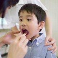 Sức khỏe - Cách đối phó viêm họng cấp tính ở trẻ